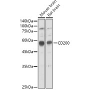 Western blot analysis of various lysates using CD200 Antibody at 1/1000 dilution. Secondary antibody: HRP-conjugated Goat anti-Rabbit IgG (H+L) at 1/10000 dilution. Lysates/proteins: 25 µg per lane. Blocking buffer: 3% nonfat dry milk in TBST. Exposure time: 60s.