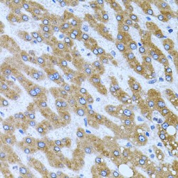 Carboxypeptidase M (CPM) Antibody