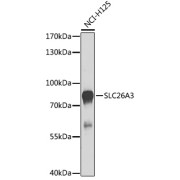 Western blot analysis of lysates from NCI-H125 cells, using SLC26A3 Antibody at 1/1000 dilution. Secondary antibody: HRP-conjugated Goat anti-Rabbit IgG (H+L) at 1/10000 dilution. Lysates/proteins: 25 µg per lane. Blocking buffer: 3% nonfat dry milk in TBST. Exposure time: 90s.