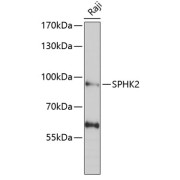 Western blot analysis of lysates from Raji cells, using SPHK2 Antibody at 1/1000 dilution. Secondary antibody: HRP-conjugated Goat anti-Rabbit IgG (H+L) at 1/10000 dilution. Lysates/proteins: 25 µg per lane. Blocking buffer: 3% nonfat dry milk in TBST. Exposure time: 90s.