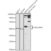 Western blot analysis of various lysates using TIN2/TINF2 Antibody at 1/1000 dilution. Secondary antibody: HRP-conjugated Goat anti-Rabbit IgG (H+L) at 1/10000 dilution. Lysates/proteins: 25 µg per lane. Blocking buffer: 3% nonfat dry milk in TBST. Exposure time: 90s.