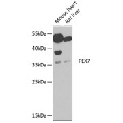 Western blot analysis of various lysates using PEX7 Antibody at 1/1000 dilution. Secondary antibody: HRP-conjugated Goat anti-Rabbit IgG (H+L) at 1/10000 dilution. Lysates/proteins: 25 µg per lane. Blocking buffer: 3% nonfat dry milk in TBST. Exposure time: 90s.