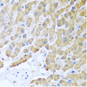 Immunohistochemistry analysis of paraffin-embedded Human liver using CCL8 Antibody at dilution of 1/100 (40x lens). Microwave antigen retrieval performed in 0.01 M PBS Buffer (pH 7.2) prior to IHC staining.