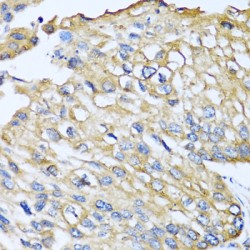 C-C Motif Chemokine 8 / MCP2 (CCL8) Antibody