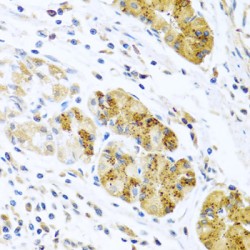 C-C Motif Chemokine 8 / MCP2 (CCL8) Antibody