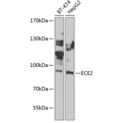 Western blot analysis of various lysates using ECE2 Antibody at 1/1000 dilution. Secondary antibody: HRP-conjugated Goat anti-Rabbit IgG (H+L) at 1/10000 dilution. Lysates/proteins: 25 µg per lane. Blocking buffer: 3% nonfat dry milk in TBST. Exposure time: 30s.