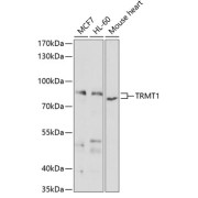 Western blot analysis of various lysates using TRMT1 Antibody at 1/1000 dilution. Secondary antibody: HRP-conjugated Goat anti-Rabbit IgG (H+L) at 1/10000 dilution. Lysates/proteins: 25 µg per lane. Blocking buffer: 3% nonfat dry milk in TBST. Exposure time: 90s.