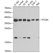 Western blot analysis of various lysates using PTCRA Antibody at 1/1000 dilution. Secondary antibody: HRP-conjugated Goat anti-Rabbit IgG (H+L) at 1/10000 dilution. Lysates/proteins: 25 µg per lane. Blocking buffer: 3% nonfat dry milk in TBST. Exposure time: 90s.