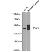 Western blot analysis of various lysates using TACR3 Antibody at 1/1000 dilution. Secondary antibody: HRP-conjugated Goat anti-Rabbit IgG (H+L) at 1/10000 dilution. Lysates/proteins: 25 µg per lane. Blocking buffer: 3% nonfat dry milk in TBST. Exposure time: 90s.