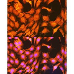 Phosphorylase Kinase Catalytic Subunit Gamma 2 (PHKG2) Antibody