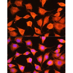 Phosphorylase Kinase Catalytic Subunit Gamma 2 (PHKG2) Antibody