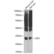 Western blot analysis of various lysates using CER1 Antibody at 1/1000 dilution. Secondary antibody: HRP-conjugated Goat anti-Rabbit IgG (H+L) at 1/10000 dilution. Lysates/proteins: 25 µg per lane. Blocking buffer: 3% nonfat dry milk in TBST. Exposure time: 90s.