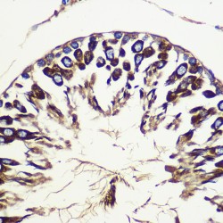 Ubiquitin-Like-Conjugating Enzyme ATG10 (ATG10) Antibody