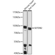 Western blot analysis of various lysates using SETDB2 Antibody at 1/1000 dilution. Secondary antibody: HRP-conjugated Goat anti-Rabbit IgG (H+L) at 1/10000 dilution. Lysates/proteins: 25 µg per lane. Blocking buffer: 3% nonfat dry milk in TBST. Exposure time: 90s.