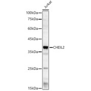 Western blot analysis of lysates from Jurkat cells, using CHI3L2 Antibody at 1/2000 dilution. Secondary antibody: HRP-conjugated Goat anti-Rabbit IgG (H+L) at 1/10000 dilution. Lysates/proteins: 25 µg per lane. Blocking buffer: 3% nonfat dry milk in TBST. Exposure time: 60s.