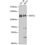 Western blot analysis of various lysates using DDX11 Antibody at 1/1000 dilution. Secondary antibody: HRP-conjugated Goat anti-Rabbit IgG (H+L) at 1/10000 dilution. Lysates/proteins: 25 µg per lane. Blocking buffer: 3% nonfat dry milk in TBST. Exposure time: 20s.