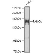 Western blot analysis of lysates from HeLa cells, using FANCA Antibody at 1/1000 dilution. Secondary antibody: HRP-conjugated Goat anti-Rabbit IgG (H+L) at 1/10000 dilution. Lysates/proteins: 25 µg per lane. Blocking buffer: 3% nonfat dry milk in TBST. Exposure time: 30s.