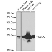 Western blot analysis of various lysates using GSTA2 Antibody at 1/1000 dilution. Secondary antibody: HRP-conjugated Goat anti-Rabbit IgG (H+L) at 1/10000 dilution. Lysates/proteins: 25 µg per lane. Blocking buffer: 3% nonfat dry milk in TBST. Exposure time: 90s.