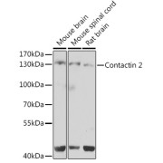 Western blot analysis of various lysates using Contactin 2 Antibody at 1/1000 dilution. Secondary antibody: HRP-conjugated Goat anti-Rabbit IgG (H+L) at 1/10000 dilution. Lysates/proteins: 25 µg per lane. Blocking buffer: 3% nonfat dry milk in TBST. Exposure time: 30s.