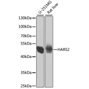 Western blot analysis of various lysates using HARS2 Antibody at 1/1000 dilution. Secondary antibody: HRP-conjugated Goat anti-Rabbit IgG (H+L) at 1/10000 dilution. Lysates/proteins: 25 µg per lane. Blocking buffer: 3% nonfat dry milk in TBST. Exposure time: 5s.