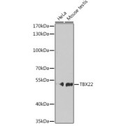 Western blot analysis of various lysates using TBX22 Antibody at 1/1000 dilution. Secondary antibody: HRP-conjugated Goat anti-Rabbit IgG (H+L) at 1/10000 dilution. Lysates/proteins: 25 µg per lane. Blocking buffer: 3% nonfat dry milk in TBST. Exposure time: 90s.