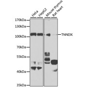 Western blot analysis of various lysates using TNNI3K Antibody at 1/1000 dilution. Secondary antibody: HRP-conjugated Goat anti-Rabbit IgG (H+L) at 1/10000 dilution. Lysates/proteins: 25 µg per lane. Blocking buffer: 3% nonfat dry milk in TBST. Exposure time: 90s.