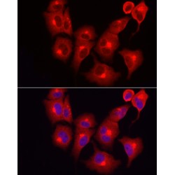 Inositol Polyphosphate 5-Phosphatase K (INPP5K) Antibody