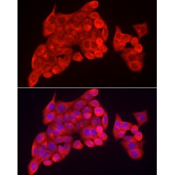 Inositol Polyphosphate 5-Phosphatase K (INPP5K) Antibody