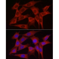 Inositol Polyphosphate 5-Phosphatase K (INPP5K) Antibody