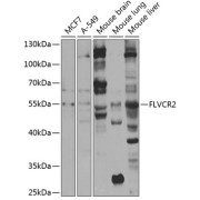 Western blot analysis of various lysates using FLVCR2 Antibody at 1/1000 dilution. Secondary antibody: HRP-conjugated Goat anti-Rabbit IgG (H+L) at 1/10000 dilution. Lysates/proteins: 25 µg per lane. Blocking buffer: 3% nonfat dry milk in TBST. Exposure time: 5s.