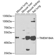 Western blot analysis of various lysates using TMEM184A Antibody at 1/1000 dilution. Secondary antibody: HRP-conjugated Goat anti-Rabbit IgG (H+L) at 1/10000 dilution. Lysates/proteins: 25 µg per lane. Blocking buffer: 3% nonfat dry milk in TBST. Exposure time: 90s.