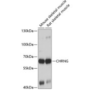 Western blot analysis of various lysates using CHRNG Antibody at 1/1000 dilution. Secondary antibody: HRP-conjugated Goat anti-Rabbit IgG (H+L) at 1/10000 dilution. Lysates/proteins: 25 µg per lane. Blocking buffer: 3% nonfat dry milk in TBST. Exposure time: 3s.