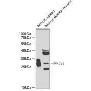 Western blot analysis of various lysates using PRSS2 Antibody at 1/1000 dilution. Secondary antibody: HRP-conjugated Goat anti-Rabbit IgG (H+L) at 1/10000 dilution. Lysates/proteins: 25 µg per lane. Blocking buffer: 3% nonfat dry milk in TBST. Exposure time: 90s.