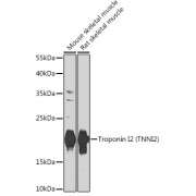 Western blot analysis of various lysates using Troponin I2 (TNNI2) Antibody at 1/1000 dilution. Secondary antibody: HRP-conjugated Goat anti-Rabbit IgG (H+L) at 1/10000 dilution. Lysates/proteins: 25 µg per lane. Blocking buffer: 3% nonfat dry milk in TBST. Exposure time: 30s.