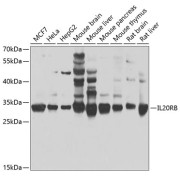 Western blot analysis of various lysates using IL20RB Antibody at 1/1000 dilution. Secondary antibody: HRP-conjugated Goat anti-Rabbit IgG (H+L) at 1/10000 dilution. Lysates/proteins: 25 µg per lane. Blocking buffer: 3% nonfat dry milk in TBST. Exposure time: 30s.