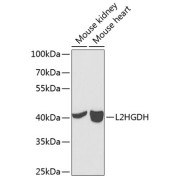 Western blot analysis of various lysates using L2HGDH Antibody at 1/1000 dilution. Secondary antibody: HRP-conjugated Goat anti-Rabbit IgG (H+L) at 1/10000 dilution. Lysates/proteins: 25 µg per lane. Blocking buffer: 3% nonfat dry milk in TBST. Exposure time: 90s.