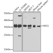 Western blot analysis of various lysates using RFC5 Antibody at 1/1000 dilution. Secondary antibody: HRP-conjugated Goat anti-Rabbit IgG (H+L) at 1/10000 dilution. Lysates/proteins: 25 µg per lane. Blocking buffer: 3% nonfat dry milk in TBST. Exposure time: 30s.