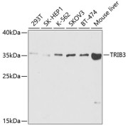 Western blot analysis of lysates from Mouse liver using TRIB3 Antibody at 1/1000 dilution. AS014 Secondary antibody:(Rabbit) at 1/10000 dilution. Lysates/proteins: 25 µg per lane. Blocking buffer: 3% nonfat dry milk in TBST. Detection:(Mouse). Exposure time: 120s.