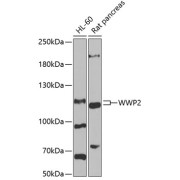 Western blot analysis of various lysates using WWP2 Antibody at 1/1000 dilution. Secondary antibody: HRP-conjugated Goat anti-Rabbit IgG (H+L) at 1/10000 dilution. Lysates/proteins: 25 µg per lane. Blocking buffer: 3% nonfat dry milk in TBST. Exposure time: 60s.