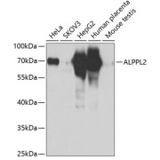 Western blot analysis of various lysates using ALPPL2 Antibody at 1/1000 dilution. Secondary antibody: HRP-conjugated Goat anti-Rabbit IgG (H+L) at 1/10000 dilution. Lysates/proteins: 25 µg per lane. Blocking buffer: 3% nonfat dry milk in TBST. Exposure time: 3s.