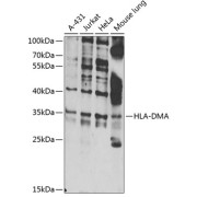 Western blot analysis of various lysates using HLA-DMA Antibody at 1/1000 dilution. Secondary antibody: HRP-conjugated Goat anti-Rabbit IgG (H+L) at 1/10000 dilution. Lysates/proteins: 25 µg per lane. Blocking buffer: 3% nonfat dry milk in TBST. Exposure time: 30s.