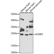 Western blot analysis of various lysates using KCNIP2 Antibody at 1/1000 dilution. Secondary antibody: HRP-conjugated Goat anti-Rabbit IgG (H+L) at 1/10000 dilution. Lysates/proteins: 25 µg per lane. Blocking buffer: 3% nonfat dry milk in TBST. Exposure time: 90s.