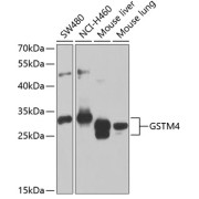 Western blot analysis of various lysates using GSTM4 Antibody at 1/1000 dilution. Secondary antibody: HRP-conjugated Goat anti-Rabbit IgG (H+L) at 1/10000 dilution. Lysates/proteins: 25 µg per lane. Blocking buffer: 3% nonfat dry milk in TBST. Exposure time: 30s.