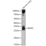 Western blot analysis of lysates from Mouse ovary, using WISP2 Antibody at 1/500 dilution. Secondary antibody: HRP-conjugated Goat anti-Rabbit IgG (H+L) at 1/10000 dilution. Lysates/proteins: 25 µg per lane. Blocking buffer: 3% nonfat dry milk in TBST. Exposure time: 90s.