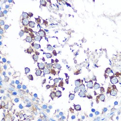 CCN Family Member 5 (CCN5) Antibody