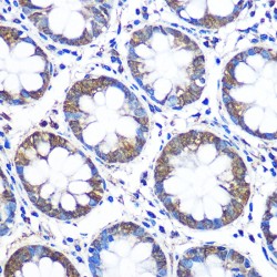 CCN Family Member 5 (CCN5) Antibody