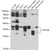 Western blot analysis of various lysates using ZNF346 Antibody at 1/1000 dilution. Secondary antibody: HRP-conjugated Goat anti-Rabbit IgG (H+L) at 1/10000 dilution. Lysates/proteins: 25 µg per lane. Blocking buffer: 3% nonfat dry milk in TBST. Exposure time: 1s.