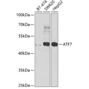 Western blot analysis of various lysates using ATF7 Antibody at 1/1000 dilution. Secondary antibody: HRP-conjugated Goat anti-Rabbit IgG (H+L) at 1/10000 dilution. Lysates/proteins: 25 µg per lane. Blocking buffer: 3% nonfat dry milk in TBST. Exposure time: 90s.