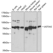 Western blot analysis of various lysates using UGT3A2 Antibody at 1/1000 dilution. Secondary antibody: HRP-conjugated Goat anti-Rabbit IgG (H+L) at 1/10000 dilution. Lysates/proteins: 25 µg per lane. Blocking buffer: 3% nonfat dry milk in TBST. Exposure time: 1s.