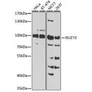 Western blot analysis of various lysates using [KO Validated] SUZ12 Antibody at 1/1000 dilution. Secondary antibody: HRP-conjugated Goat anti-Rabbit IgG (H+L) at 1/10000 dilution. Lysates/proteins: 25 µg per lane. Blocking buffer: 3% nonfat dry milk in TBST. Exposure time: 90s.